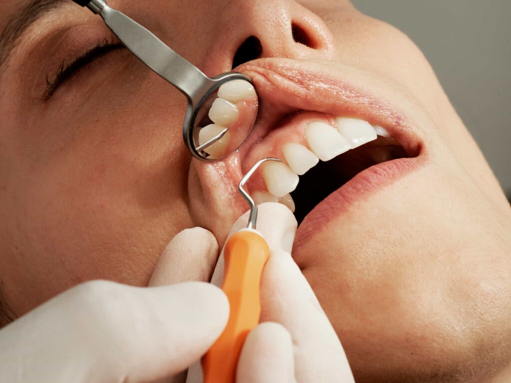 How to Choose the Right Family Dentist in Inglewood, CA 5 woman getting dental work