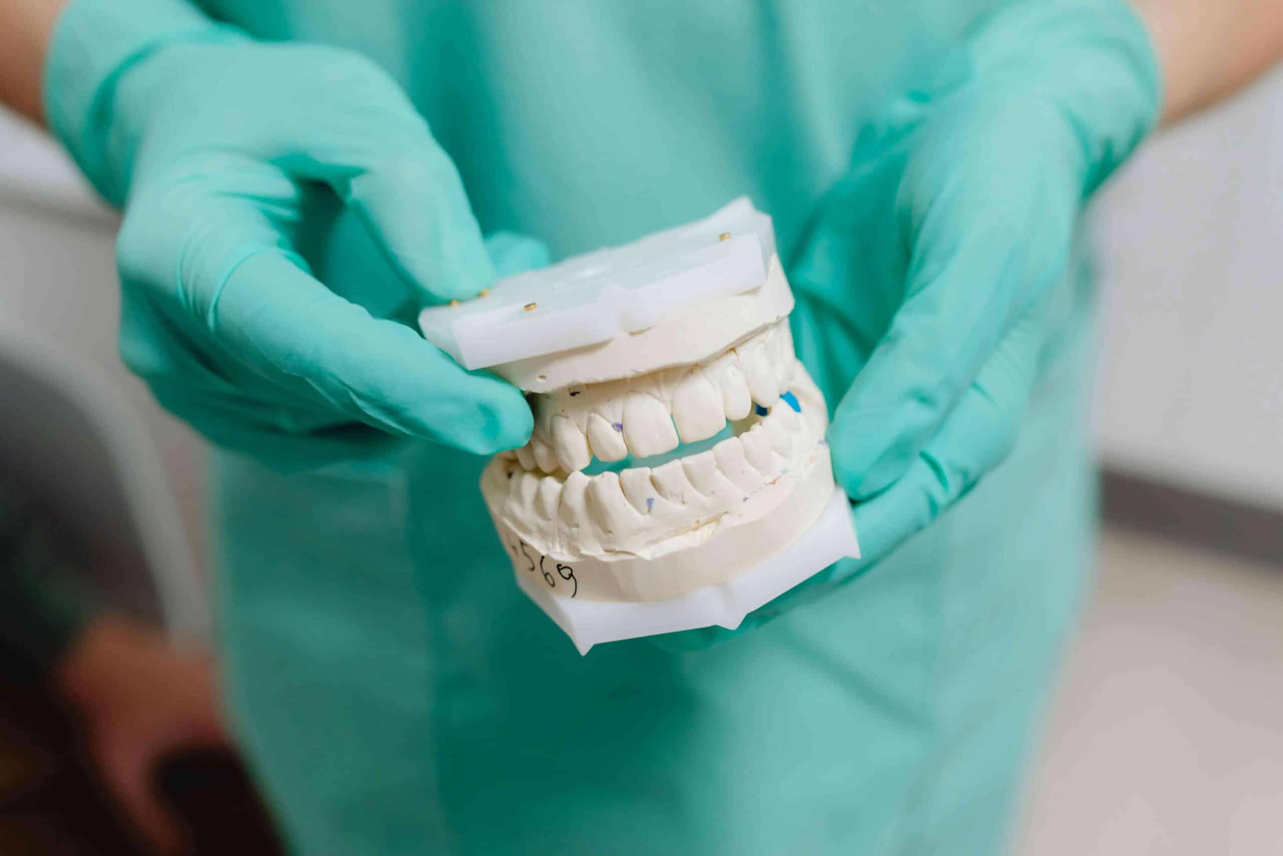 How Cavities Form: The Science of Tooth Decay Explained 5 dentist holding model teeth