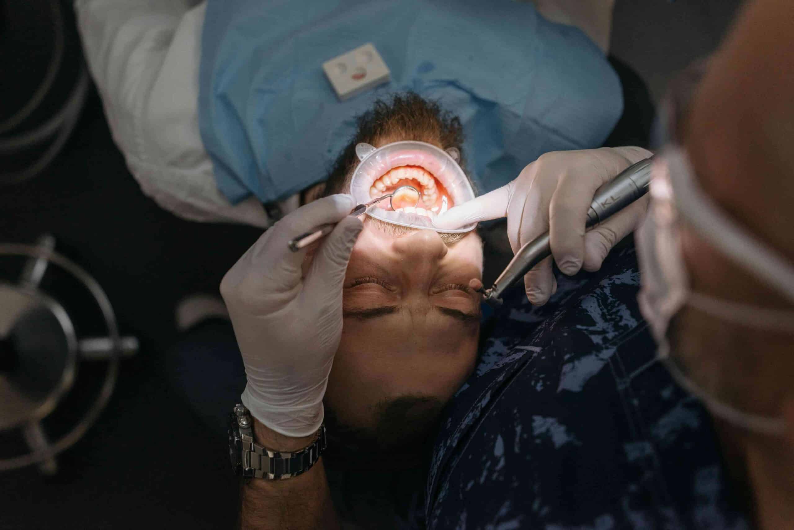 How Cavities Form: The Science of Tooth Decay Explained 6 PATIENT GETTING TEETH CHECKED
