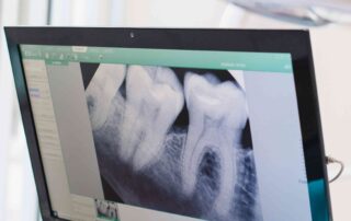 xray of teeth